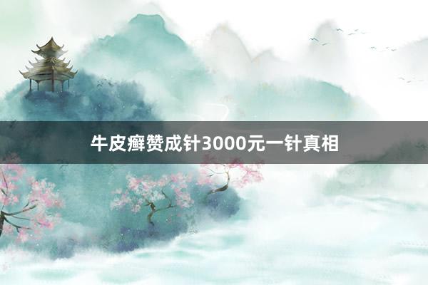 牛皮癣赞成针3000元一针真相